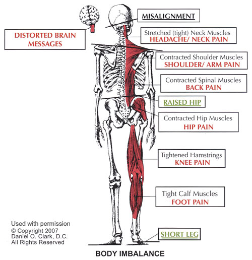 Body Imbalance